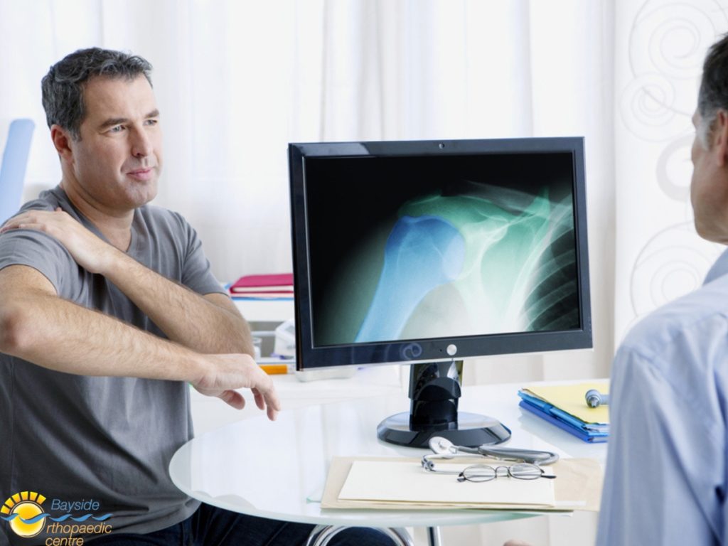 Shoulder Surgery Cleveland