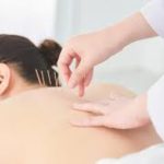 From Neck Pain to Migraines: How Acupuncture Brings Relief to Morristown Residents